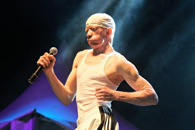King Yellowman performing on stage